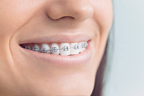 Best Invisalign and Clear Aligners  in Anderson, IN